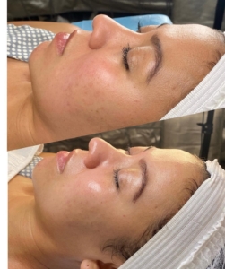customized skincare services